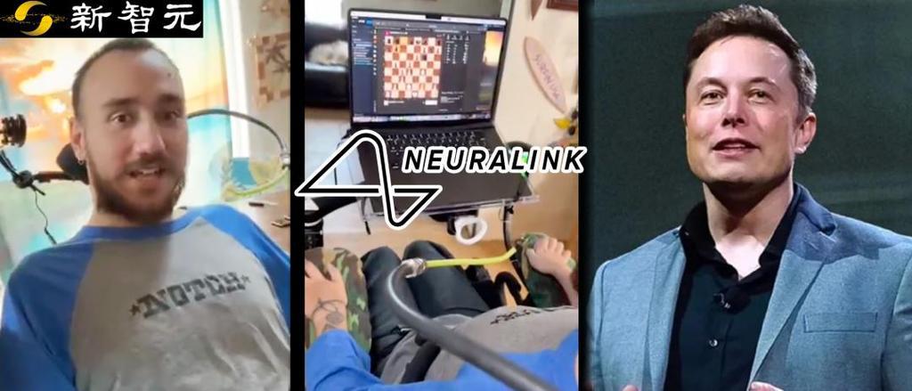马斯克Neuralink植入者直播用思维发推特